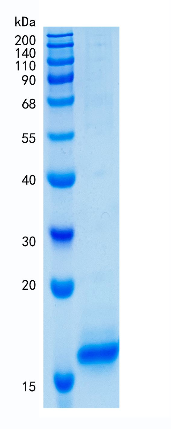 鵰 Recombinant Human Cystatin D / Cystatin-5 / CST5  Protein