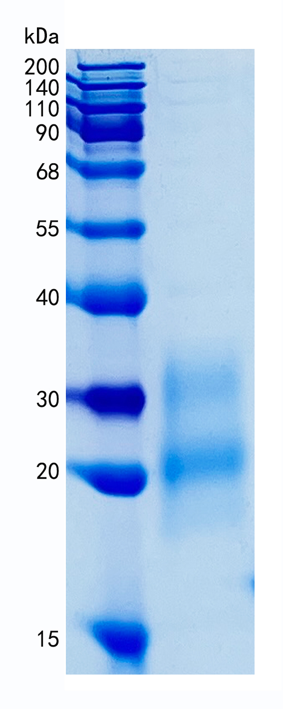鵰 Recombinant Human GM-CSF / CSF2 / MGC131935  Protein