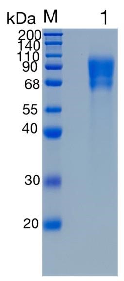 鵰 Recombinant Human CD6/T12 / T-cell differentiation antigen CD6 / T12 / TP120 / CD6 / Protein
