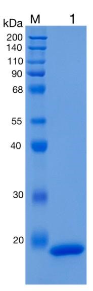 鵰 Recombinant Human LCN1 / TP / VEG protein / VEGP  Protein