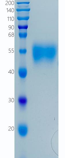 鵰 Recombinant Human IL-2RG / IL-2 R gamma / IL-2R  Protein