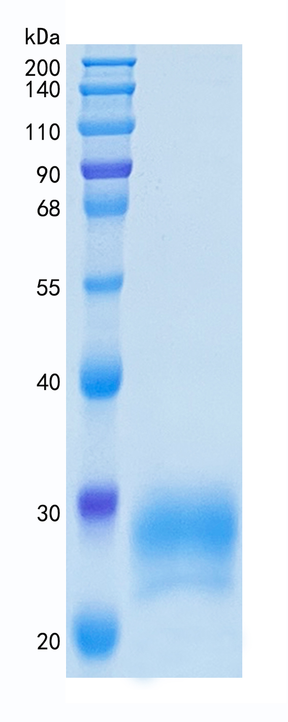 鵰 Recombinant Human CD32B / FCGR2B / FCG2 / IGFR2  Protein