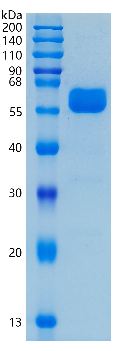 鵰 Recombinant Human CD147 / 5F7 / basigin  Protein