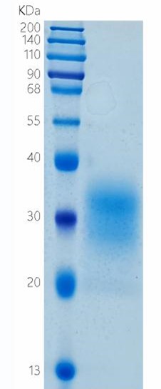 鵰 Recombinant Human CD79b / B29 / IGB  Protein