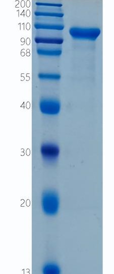 鵰 Recombinant Mouse Mmp9 / Gelatinase B /  GELB   Protein