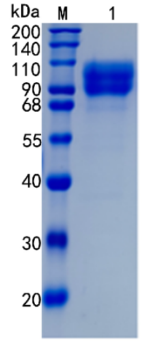 鵰 Recombinant Human CD146 / CD146 / MCAM  Protein