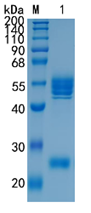 鵰 Recombinant Mouse IL-12 rMuIL-12 / NKSF / CLMF  Protein