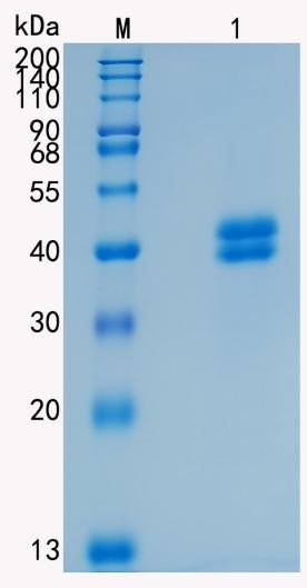 鵰 Recombinant Human PRSS8 /  CAP1 / Prss8; Serine protease 8 / Prostasin Protein