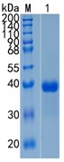 鵰 Recombinant Mouse SPARC ECM2 / SC1 / SPARC-like protein 1 Protein