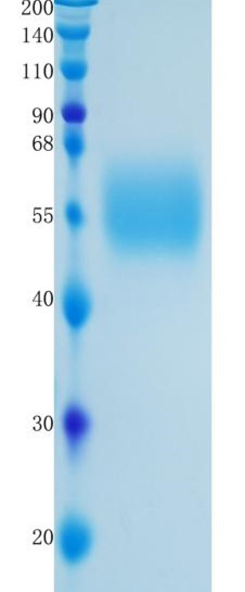 鵰 Recombinant Human MICA / MIC-A / MICA alpha 3 Protein