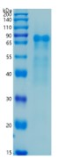 鵰 Recombinant Human Thrombomodulin THBD / TM / Fetomodulin / CD141 / THRM Protein