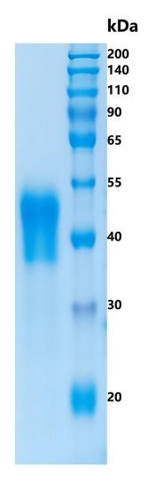 鵰 Recombinant Human CD16 FcR-10 / CD16A / FCG3 / IGFR3 / FcRIIIa / FcRIII Protein