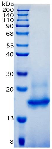 鵰 Recombinant Human CDNF / ARMETL1 / ARMET-like protein 1 / cerebral dopamine neurotrophic factor Protein