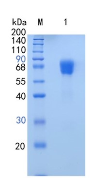 鵰 RecombinantHuman Serpin F2/alpha 2- Antiplasmin member 2 / Serpin F2 / serpin peptidase inhibitor Protein
