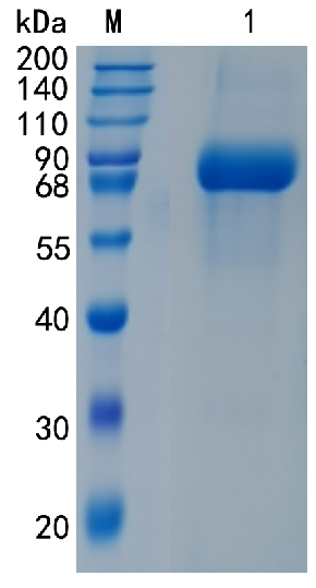 鵰 Recombinant Human IL-6/IL-6R alpha IL-6R 1 / IL6R / CD126 / IL6RQ / gp80 Protein