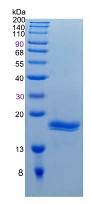 鵰 Recombinant Human REG1B /  PSPS2 / REGL  Protein