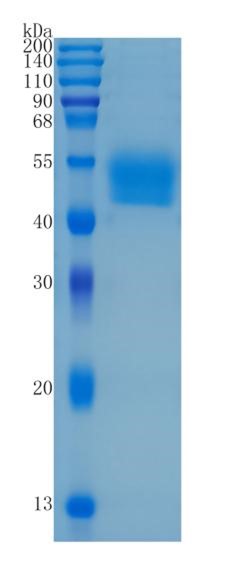 鵰 Recombinant Human Lumican / LDC / SLRR2D  Protein
