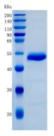 鵰 Recombinant Human EFNA4 / EphrinA4 / EFL4  Protein