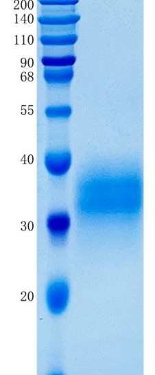 鵰 Recombinant Human Ephrin B2 / LERK-5 / NLERK-1  Protein