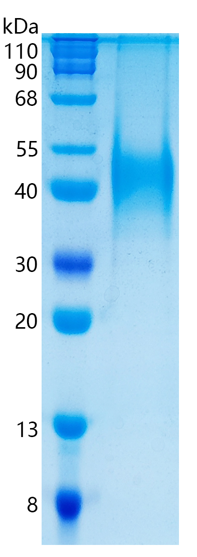 鵰 Recombinant Human CD48 / TCT.1 / CD48 / BCM1 / BLAST1 Protein