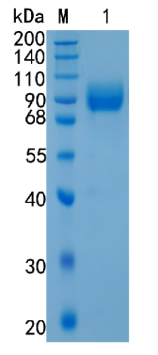 鵰 Recombinant Human Vasorin / Vasorin / Protein Slit-Like 2 / VASN / SLITL2   Protein