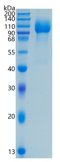 鵰 Recombinant Human  FGFR1 / CEK / FGFBR / FGFR 1  Protein
