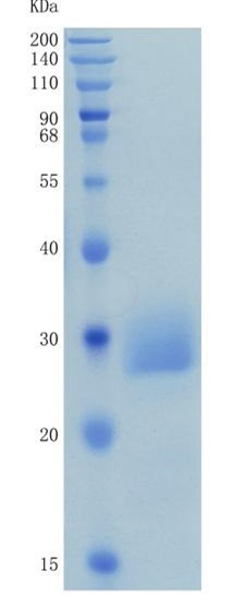 鵰 Recombinant Human CD32A / IGFR2MGC30032 / IgG Fc receptor II-a / FCG2  Protein