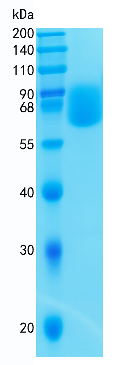 鵰 Recombinant Human ICAM- 2/CD102 / ICAM-2 / CD102 / ICAM2 Protein