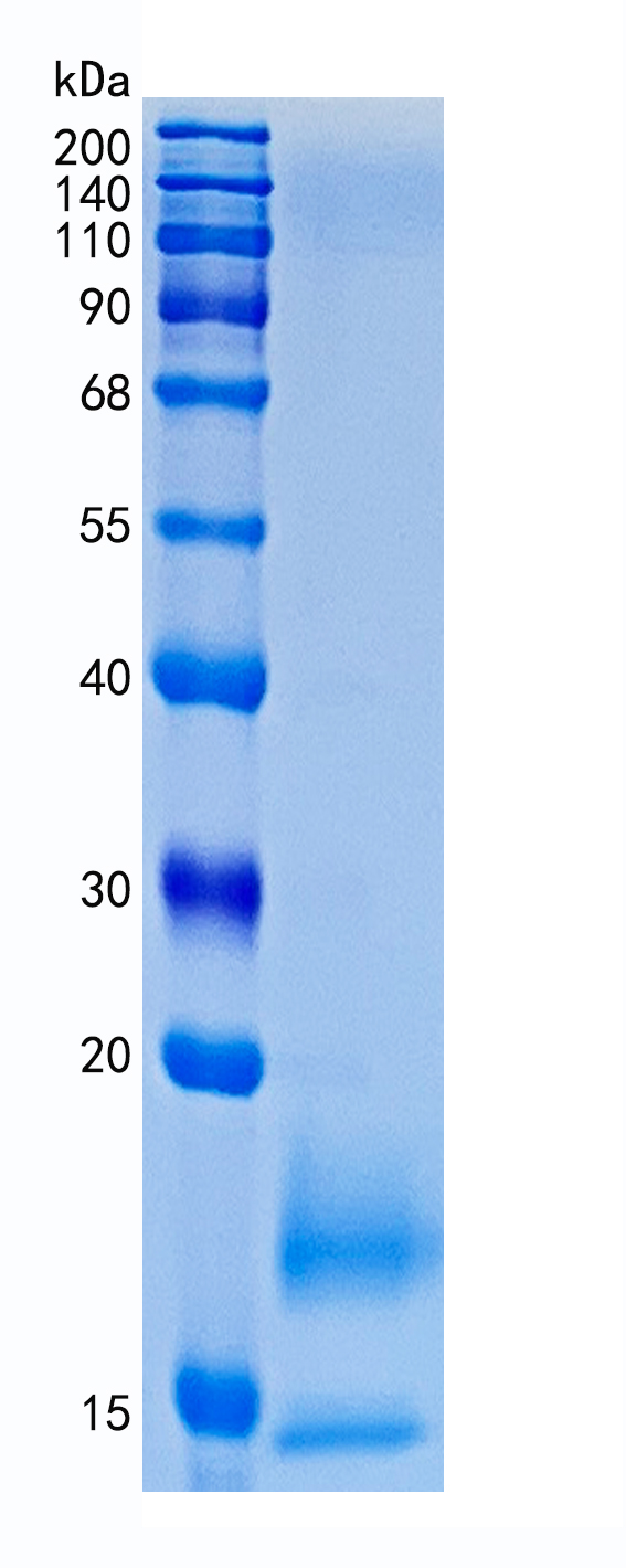 鵰 Recombinant Human CD59 / MIC11 / MIN1 / MSK21  Protein