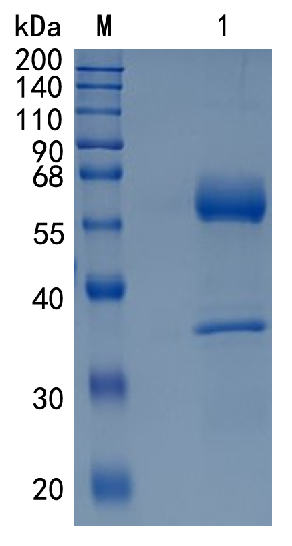 鵰Recombinant Human CLEC9A /DNGR-1 / HEEE9341 / UNQ9341 / Protein