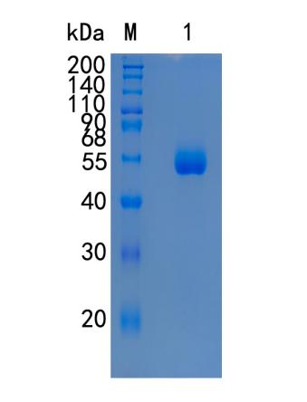 鵰 Recombinant Human CPM / Carboxypeptidase M / CPM Protein