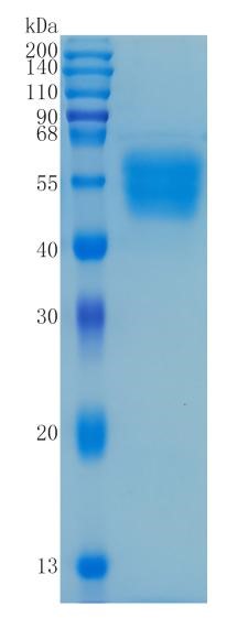 鵰 Recombinant Human IL1 Receptor I/IL-1R-1 / CD121a / IL-1 RI / IL1R  Protein