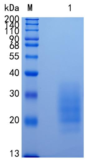 鵰Recombinant Mouse LAIR1 / mLAIR-1 / CD305 / Lair1  Protein