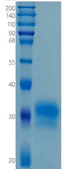鵰 Recombinant Human FOLR1 / FOLR1 / FR-alpha  Protein