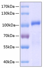 鵰 Recombinant Human MMP9 / GELB / CLG4B  Protein