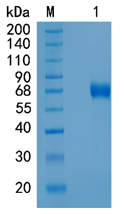 鵰Recombinant Human CHST15 / hBRAG / MGC34346 Protein