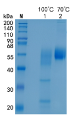 鵰Recombinant Mouse GITR / CD357 / Tnfrsf18 / GITR  Protein