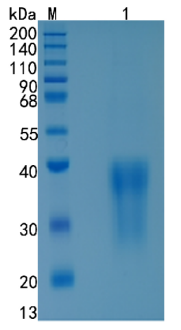 鵰 Recombinant Rat CCL2/JE/MCP-1 / CCL2 / GDCF-2 / HC11 Protein