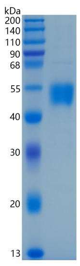 鵰Recombinant Human BTLA / BTLA1 / FLJ16065 Protein