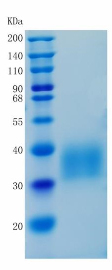 鵰 Recombinant Human PDGFR alpha / PDGFR2 / PDGFRA Protein