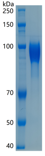 鵰 Recombinant Human CD31/PECAM-1 /  PECA1 / CD31 Protein