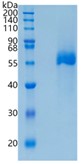 鵰Recombinant Human Vaspin / rHuVaspin / Serpin A12 / OL-64  Protein