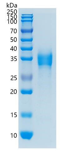 鵰 Recombinant Human EpCAM / EGP / KSA / CD326 Protein