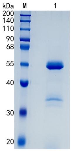 鵰 Recombinant Human CPE / CPE / CPH / CPH-1  Protein