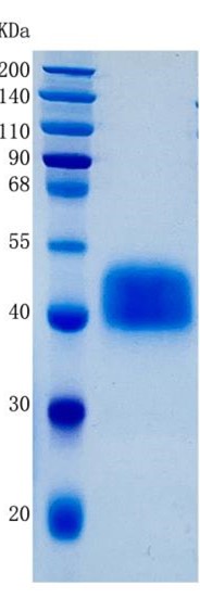 鵰 Recombinant Human IGFBP3 / IGF-BP3 / IBP-3 / IGFBP-3  Protein
