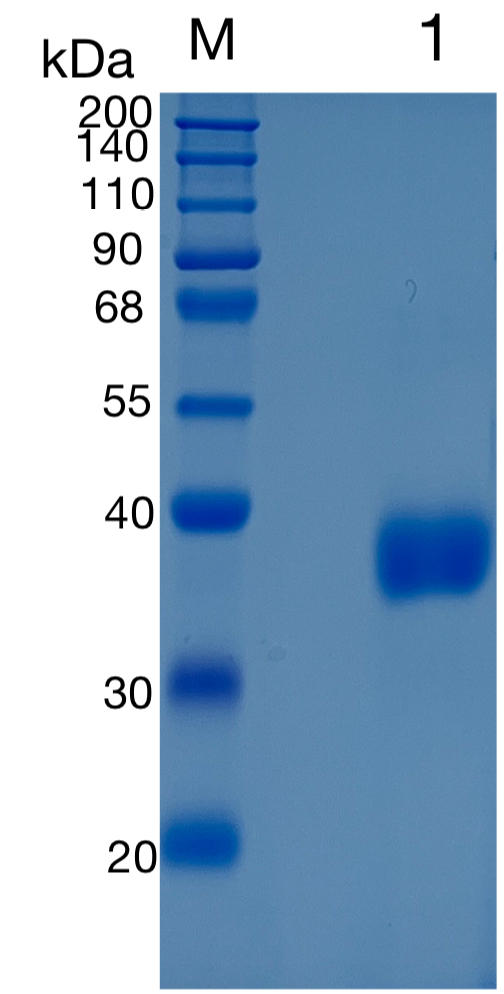 鵰 Recombinant Human Azurocidin / Azurocidin / Cationic Antimicrobial Protein CAP37  Protein
